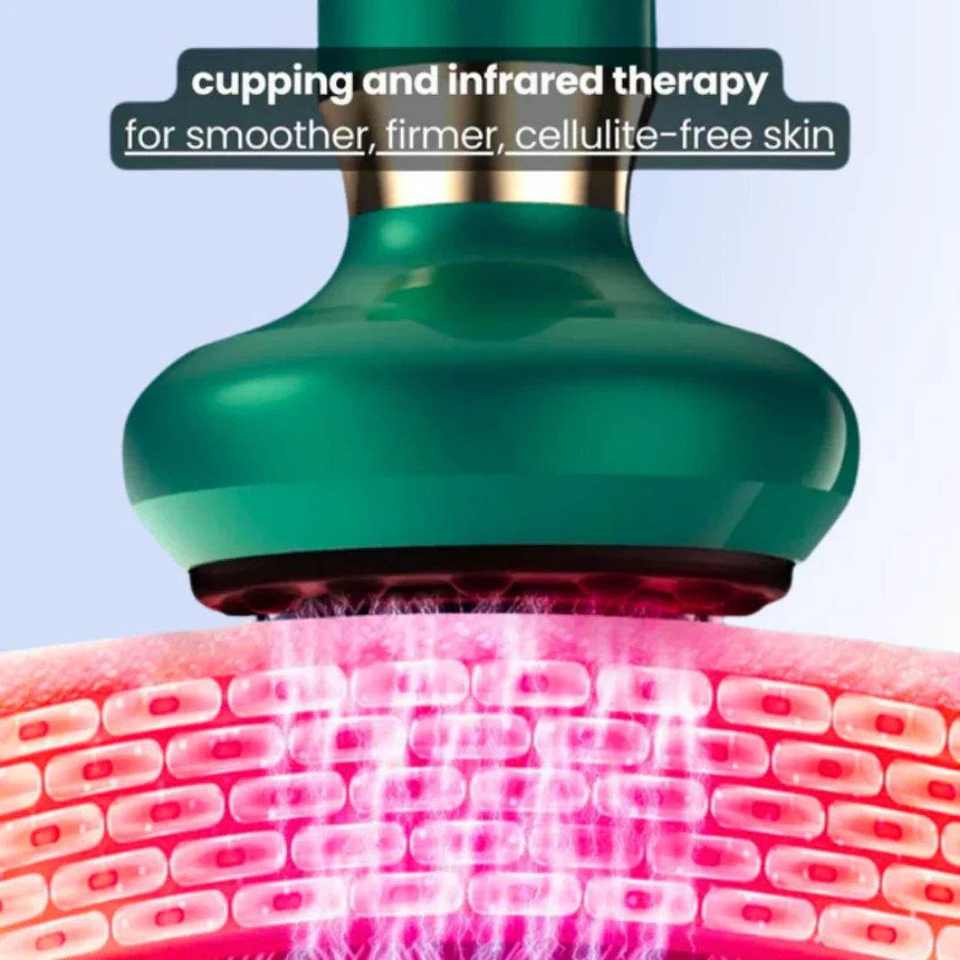 Electric Cupping Body Massager – Deep Tissue Suction & Heat Device for Muscle Relief - Image 6