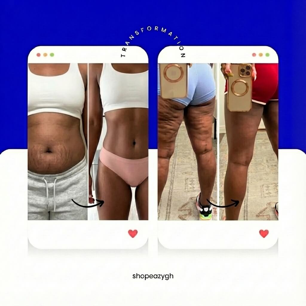 Electric Cupping Body Massager – Deep Tissue Suction & Heat Device for Muscle Relief - Image 2