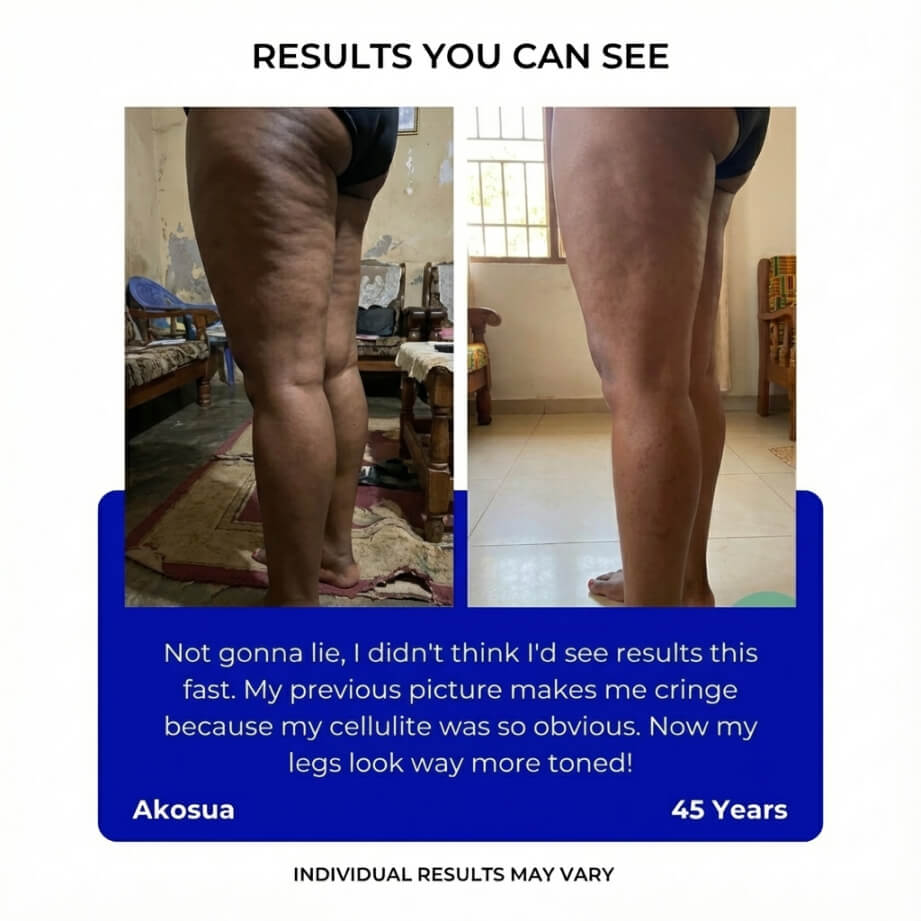 Electric Cupping Body Massager – Deep Tissue Suction & Heat Device for Muscle Relief - Image 3